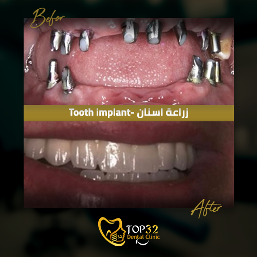 الزرعات الاقتصادية